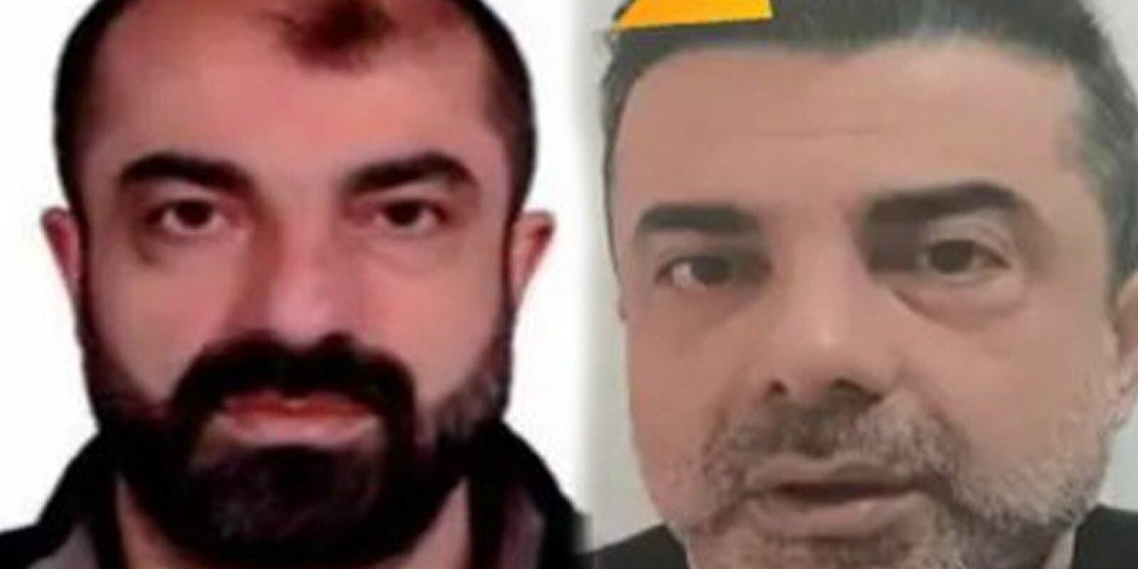 Estetik əməliyyatlarla 7 il gizlənə bildi - Foto